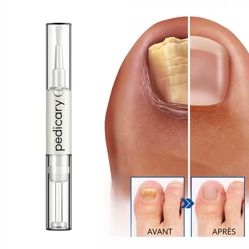 Pedicary Nail Repair Pen